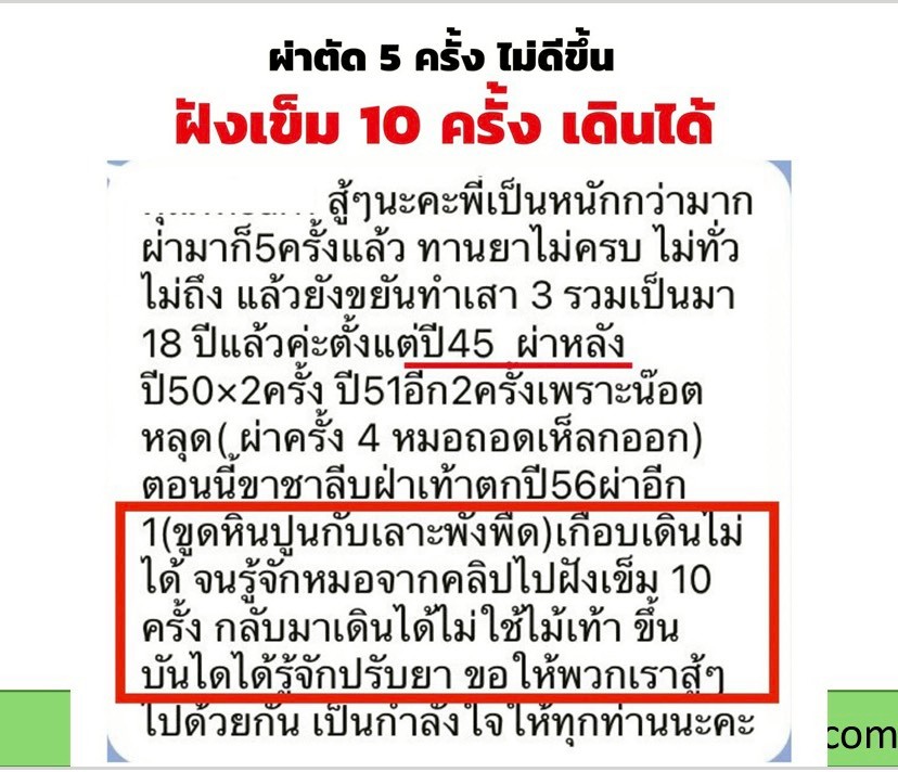 รีวิวคนไข้